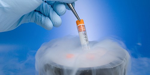 best ivf centre in Delhi, best ivf clinic in Delhi